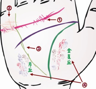 手相与疾病之间的关系