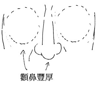 颧丰鼻厚