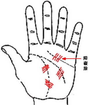 手掌中的辅助纹线——障碍线