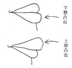 上下唇相