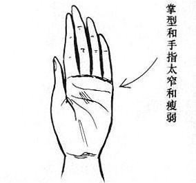 3.22掌型与面型