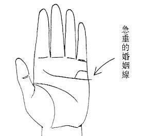 3.8下垂的婚姻线