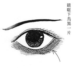 1.4眼眶黑的女性