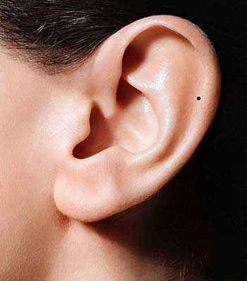 耳朵上长痣代表什么